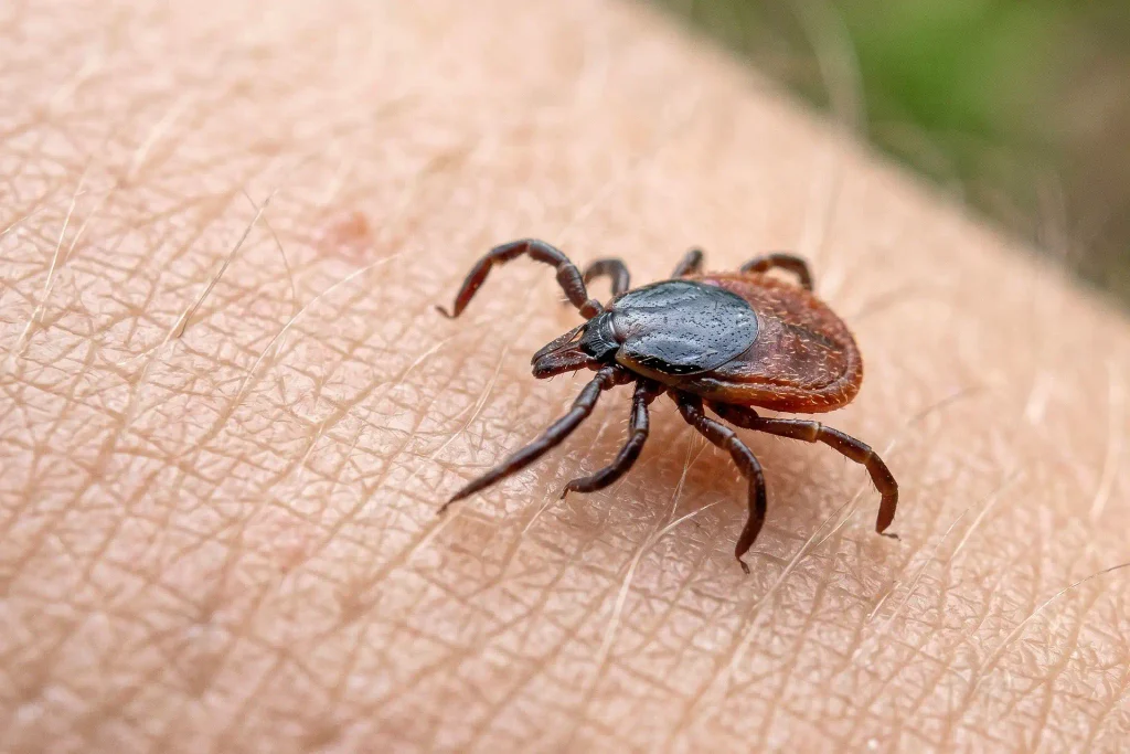 Ozonoterapia y Enfermedad de Lyme: Abordaje Integrativo para mejorar la calidad de vida 1 Ozonoterapia y Enfermedad de Lyme: Abordaje Integrativo para mejorar la calidad de vida